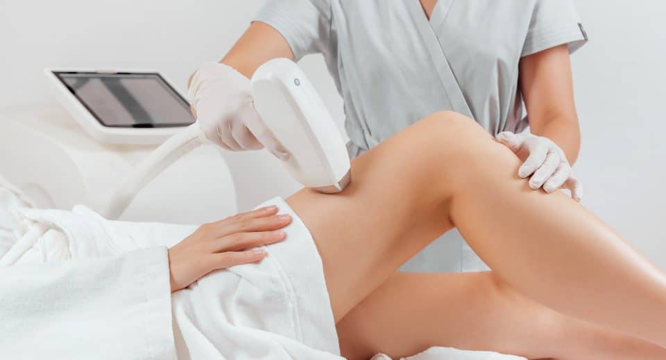 épilation laser Lyon