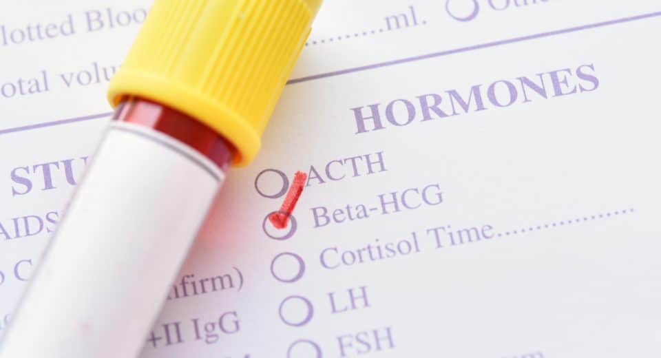 Durée d'élimination des hcg post-ivg : ce que vous devez savoir