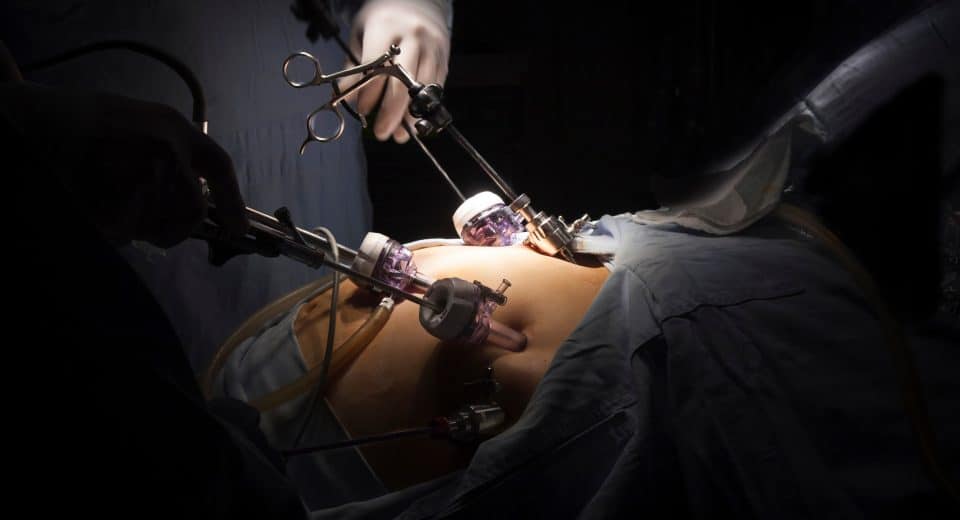 Combien de temps pour se remettre d'un bypass : durée de récupération et conseils