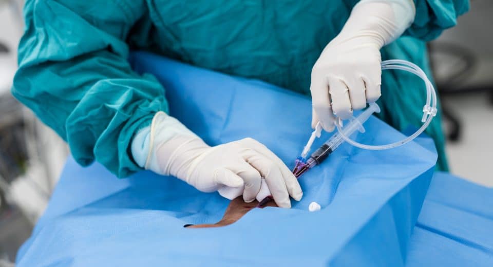 Durée maximale d'un cathéter veineux : conseils et recommandations