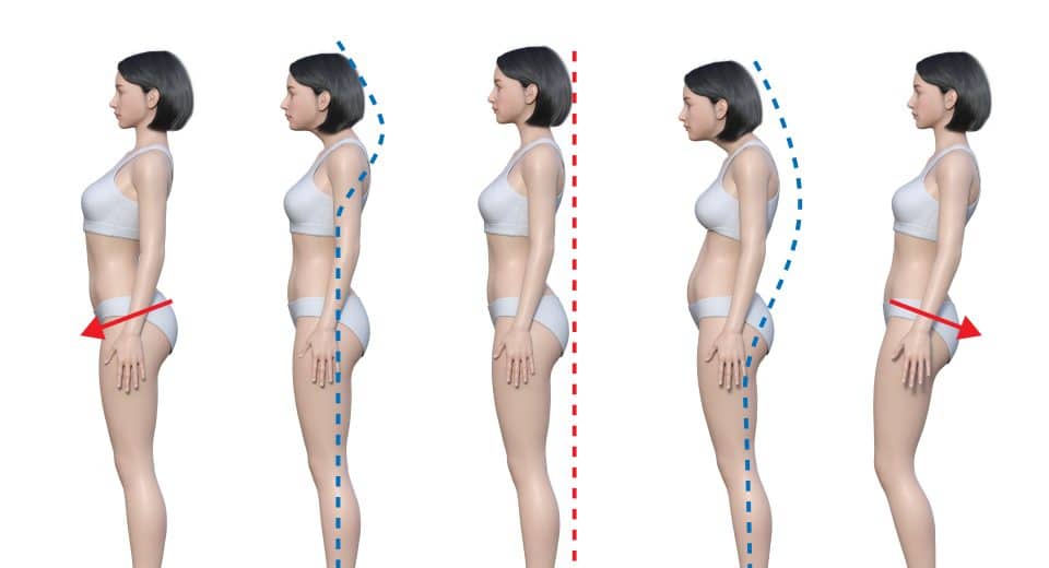 Combien de temps faut-il pour corriger sa posture ? guide complet et astuces