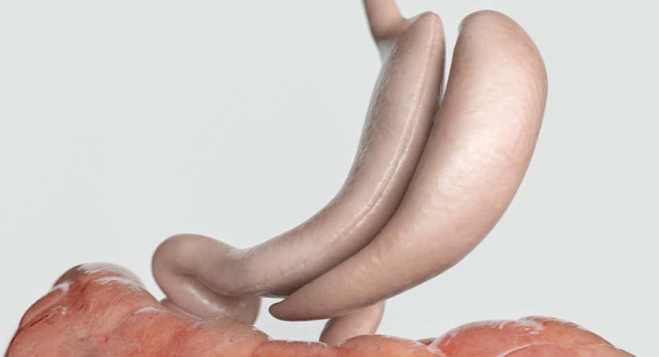 Durée de cicatrisation de l'estomac après une sleeve : ce qu'il faut savoir