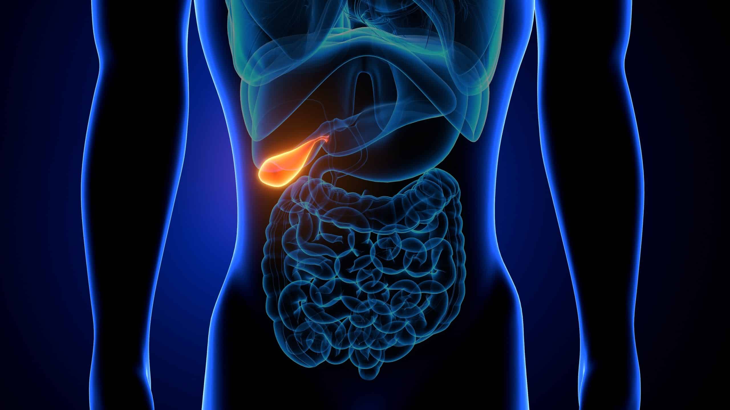 Durée de la douleur après ablation de la vésicule : témoignages forum