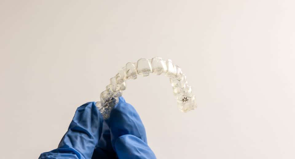 Durée de conservation d'une gouttière de blanchiment dentaire : conseils essentiels